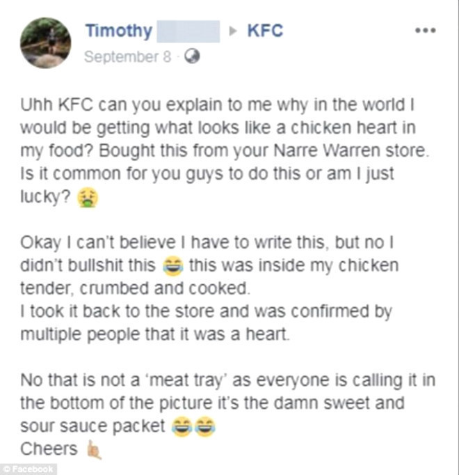 Çıtır tavuk aldı içinden çıkan şoke etti - Resim: 3