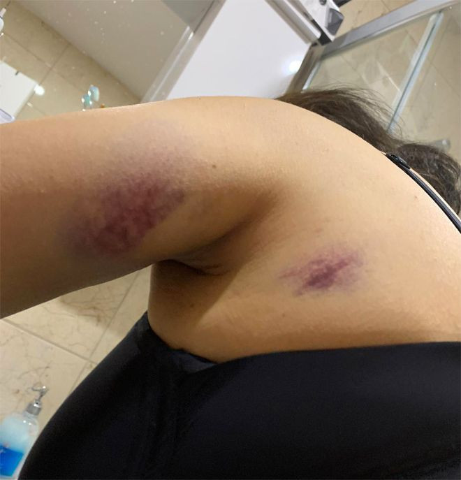 Eski eşinin kaçırıp dövdüğü kadının çığlığı! Beni kurtarın artık dayanamıyorum - Resim: 3