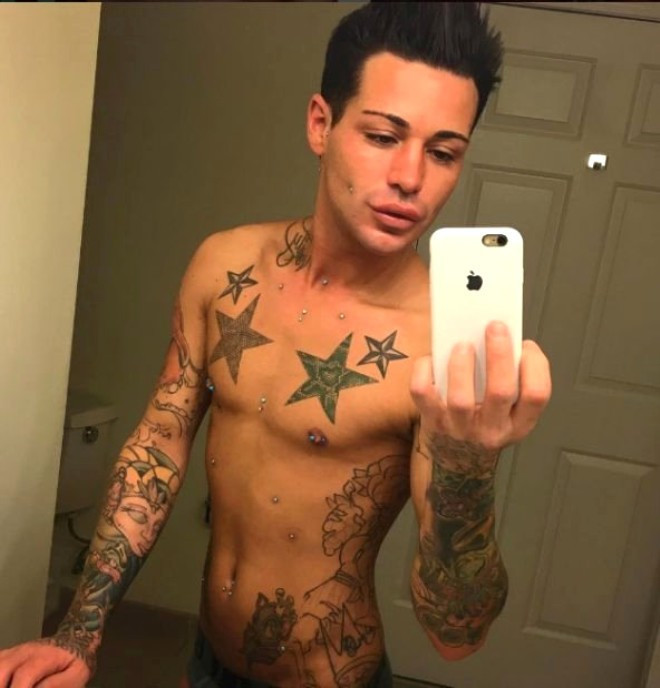 Estetikte hızını alamadı! Kalçasına bile yaptırdı - Resim: 3