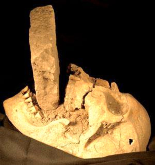 Bu kafataslarının sırrı ne ağızlarında kocaman taşlarla bulundular - Resim: 3