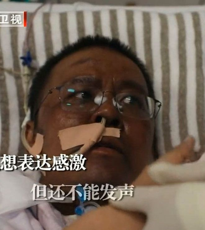 Koronavirüsü yenen iki doktor renk değiştirdi! Dünya şokta tüm hastalarda olacak mı - Resim: 4