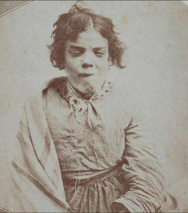 Bu fotoğraflar 1800 yılında akıl hastanesinde çekildi - Resim: 1