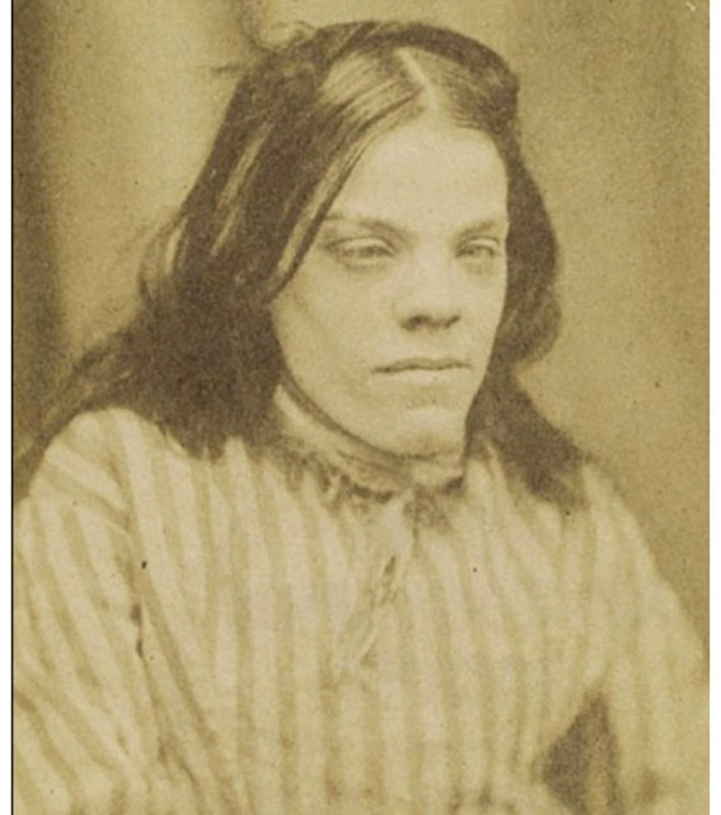 Bu fotoğraflar 1800 yılında akıl hastanesinde çekildi - Resim: 3