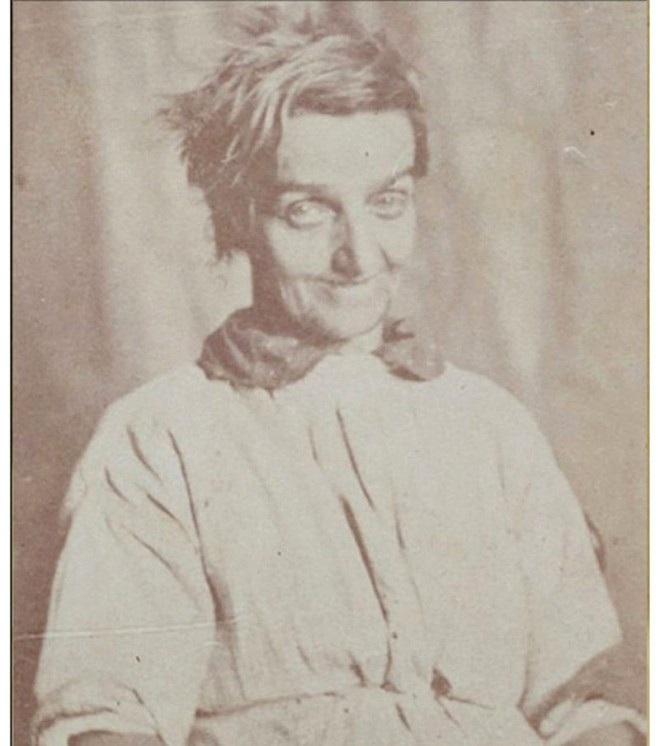 Bu fotoğraflar 1800 yılında akıl hastanesinde çekildi - Resim: 4