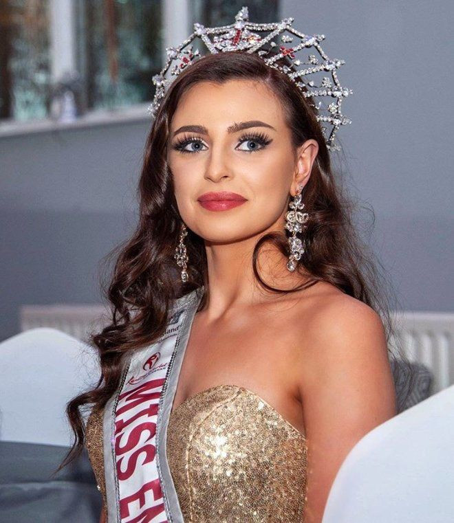 Güzellik kraliçesi Alisha Cowie'den itiraf! 4 yıldır hastalıkla boğuşuyor - Resim: 3