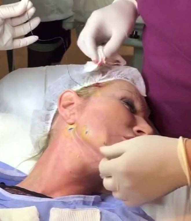 Seda Sayan operasyon görüntülerini paylaştı! Canlı yayında herkesi korkuttu - Resim: 3