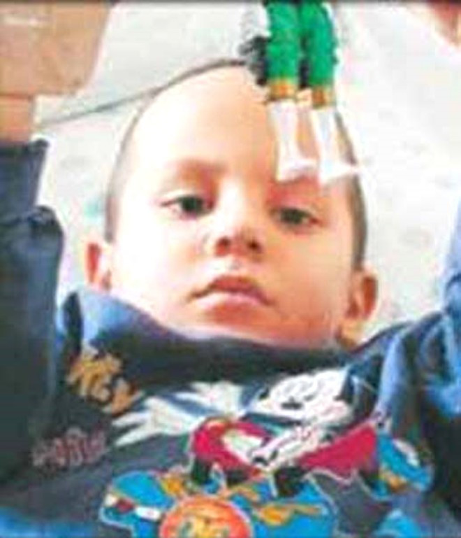 Kendini Pokemon sanıp camdan atlayan Ferhat Ağırbaş büyüdü! - Resim: 3