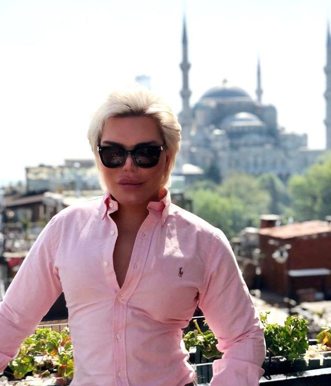 Rodrigo Alves'in son hali korkunç 70 estetik operasyon geçirdi - Resim: 3