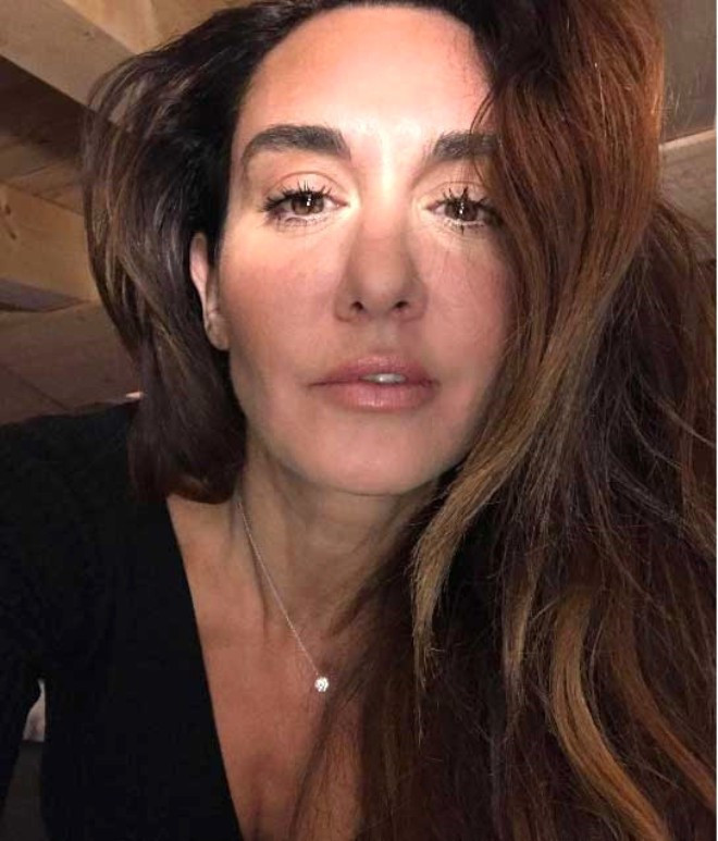 Seksenler'in Gülden'i Ayşe Tolga'nın estetiksiz haline bakın!  - Resim: 4