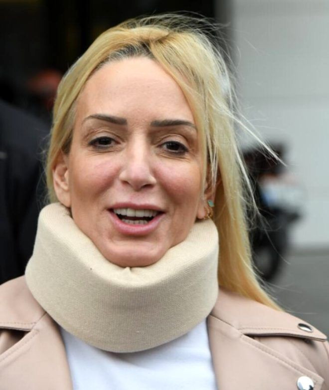 Son hali sevenlerini korkuttu Saba Tümer tanınmaz hale geldi - Resim: 2