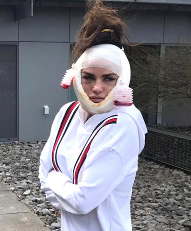 Yüz gerdirirken doktoruyla sohbet etmişti!  Son haline bakın - Resim: 3