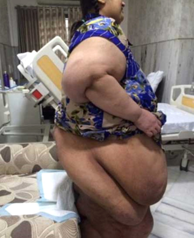 Kiloları hayatını karartmıştı! Son hali bomba - Resim: 1