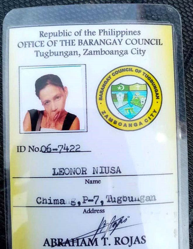 Elindeki mum yüzünden dudağı göğsüne yapışan kadının dramı - Resim: 3