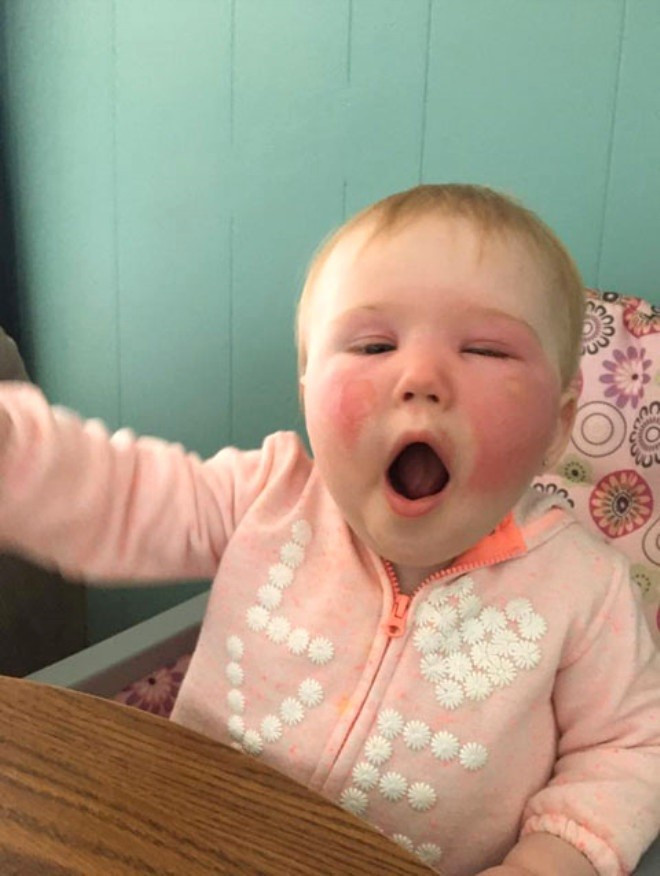 Ödünç krem bu hale getirdi! - Resim: 3