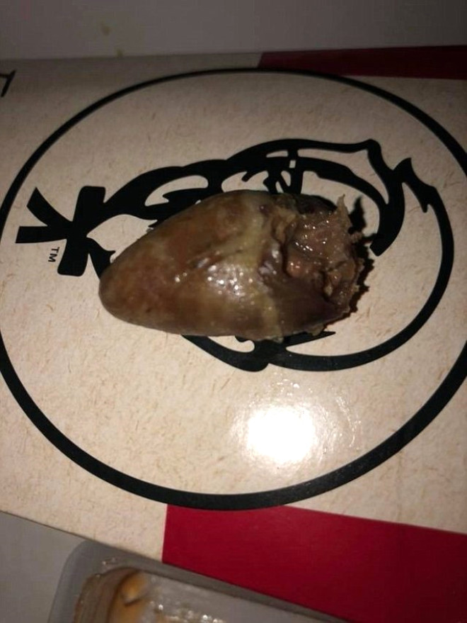 Çıtır tavuk aldı içinden çıkan şoke etti - Resim: 4