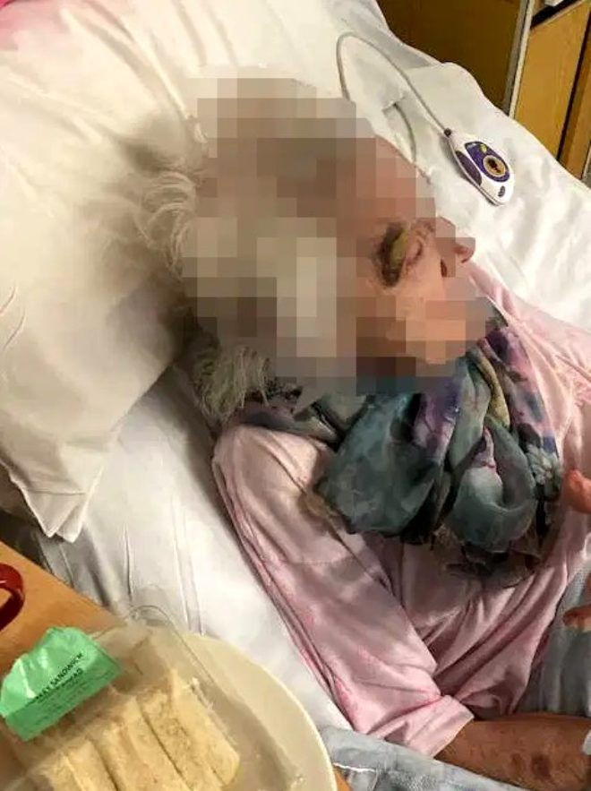 Korkunç olay! 90 yaşında kadına tecavüz edip bu hale getirdi - Resim: 2