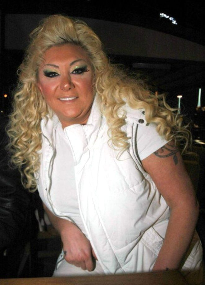 Şarkıcı Güllü son haliyle herkesi şaşırttı 70 kilo zayıfladı inanılmaz değişti - Resim: 1