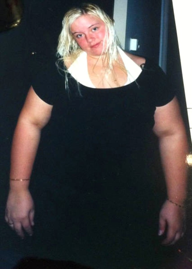 Bir anda 80 kilo verdi inanılmaz değişim - Resim: 4