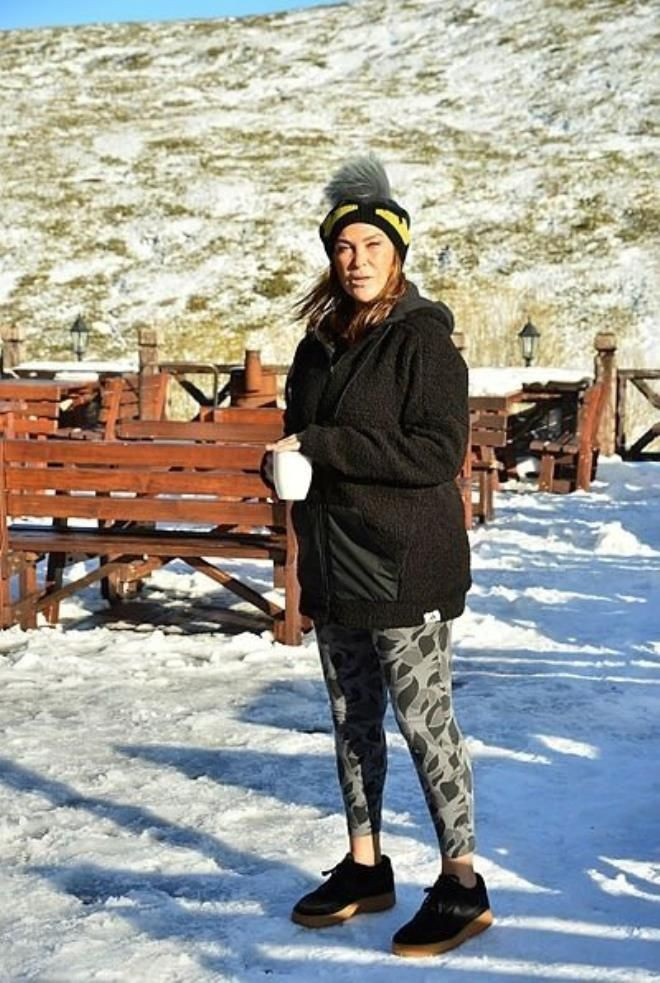 Hülya Avşar'ın yüzündeki morlukların sırrı çözüldü estetik yaptırdı denmişti - Resim: 4