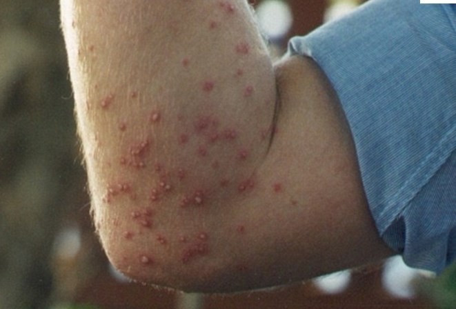 Ülke ekonomisine balta vuruyorlar Avustralya'da ortaya çıktı - Resim: 4