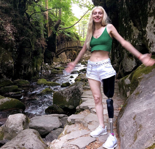 Neslican Tay hastalığı ne yoğun bakıma alınan gencin doktorundan ilk açıklama - Resim: 3