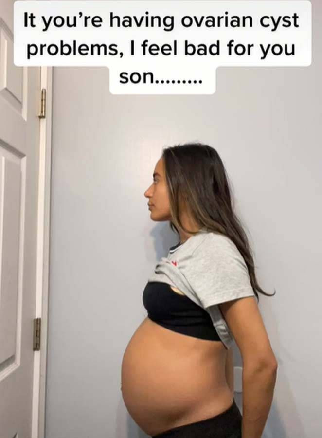 Karnı hamile gibi şişmeye başlayan kadın gerçeği öğrenince şok geçirdi! - Resim: 3