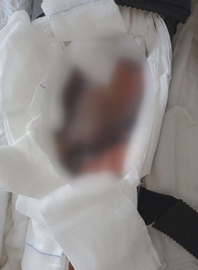 Bacağını kurtarmak için 375 bin lira ödedi hayatı kabus oldu - Resim: 3