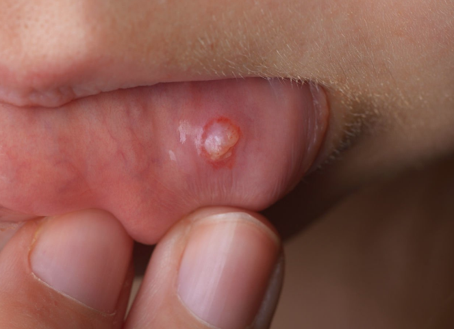 Herkeste görülüyor ama umursanmıyor! Eğer bu şekildeyse kanser ediyor - Resim: 4