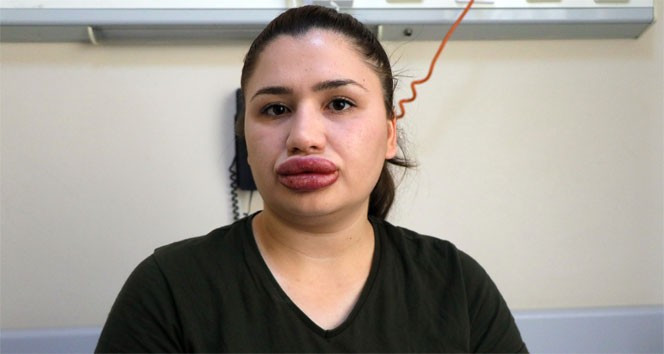 Hemşireyi bu hale getirmişti, yakalandı, ilk sözü bu oldu - Resim: 3