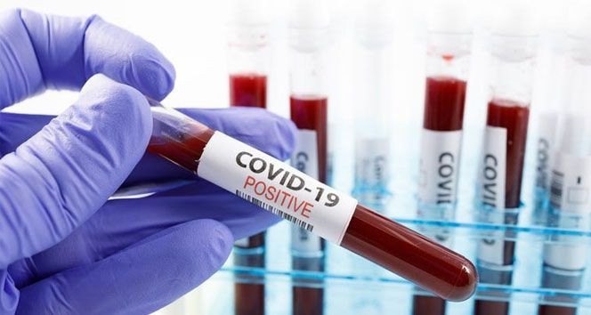 Laboratuvarda yaratmışlar, beyne saldırıyor! Mutant Covid-19, 8 gün içinde hepsini öldürdü - Resim: 4