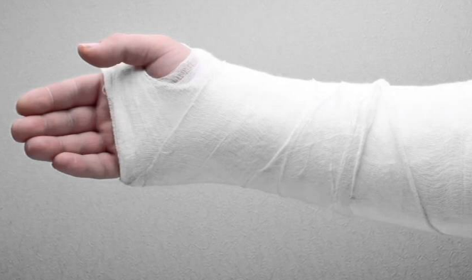 İşte kırıklar hakkında doğru bildiğimiz 5 yanlış! - Resim: 3