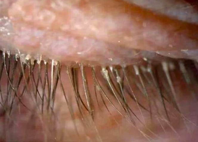 Gözünden ne çıktığını duyunca hayret edeceksiniz - Resim: 3