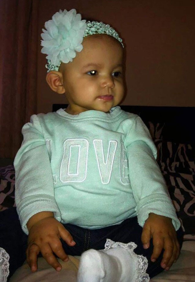 Kanser olduğu gözünden anlaşıldı! - Resim: 2