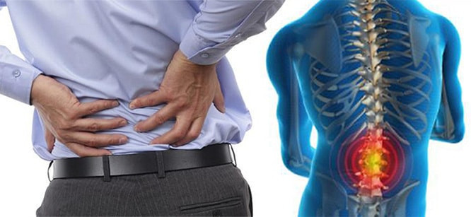 Bel fıtığına sebep olan 4 neden aman bunlardan uzak durun! - Resim: 4