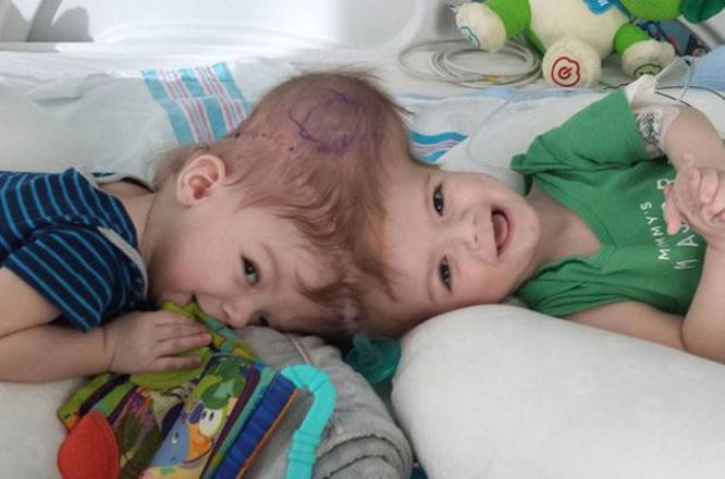 10 milyonda bir görülüyor! Mucize kurtuluş - Resim: 2