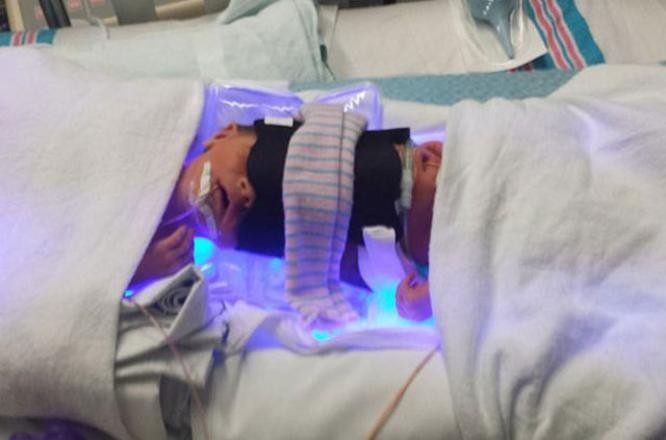 10 milyonda bir görülüyor! Mucize kurtuluş - Resim: 4