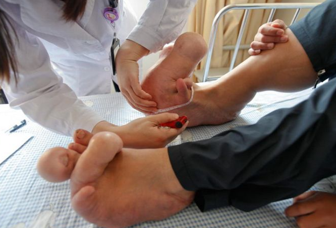 Ayakları görenleri dehşete düşürdü - Resim: 2