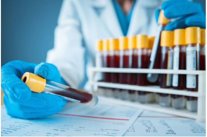 Kanser teşhisinde önemli adım! 50'den fazla kanser türünü önceden tespit edebiliyor - Resim: 1