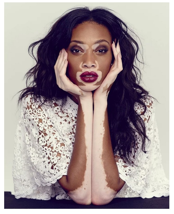 İki renkli sıradışı model! Neden böyle - Resim: 2