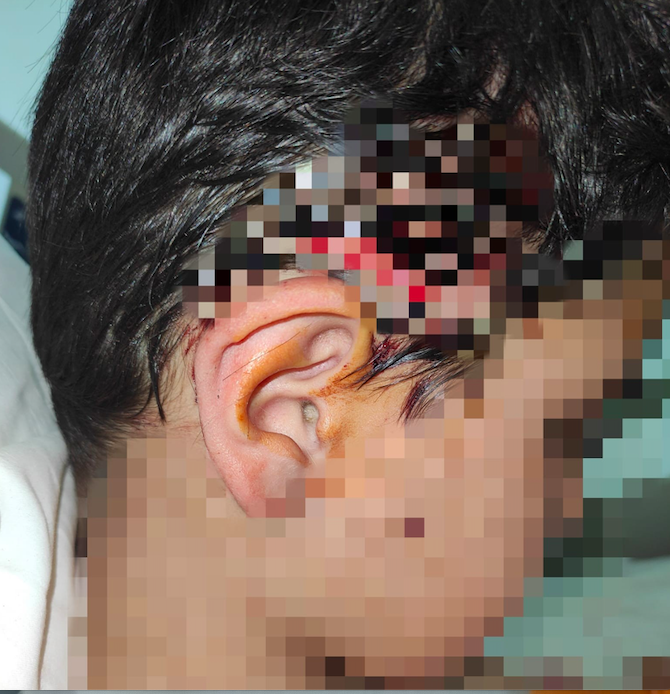 Bursa'da okula giderken 8 köpek saldırdı 80 dikiş atıldı bir motosikletli dalıp kurtardı - Resim: 3