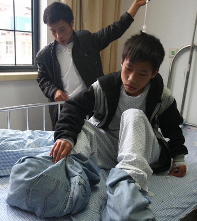 Ayakları görenleri dehşete düşürdü - Resim: 1