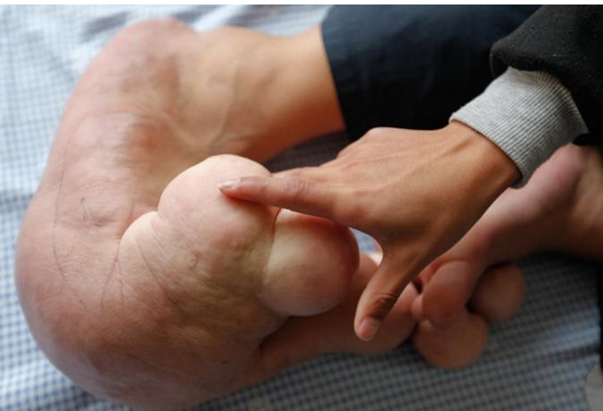 Ayakları görenleri dehşete düşürdü - Resim: 4