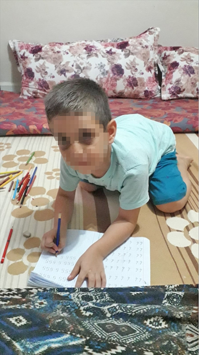 Vicdansız baba 6 yaşındaki oğlunu döve döve hastanelik etti - Resim: 2