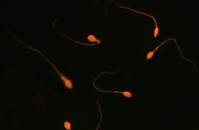 9 tane çocuğu vardı doğuştan kısır olduğunu öğrenince... - Resim: 2