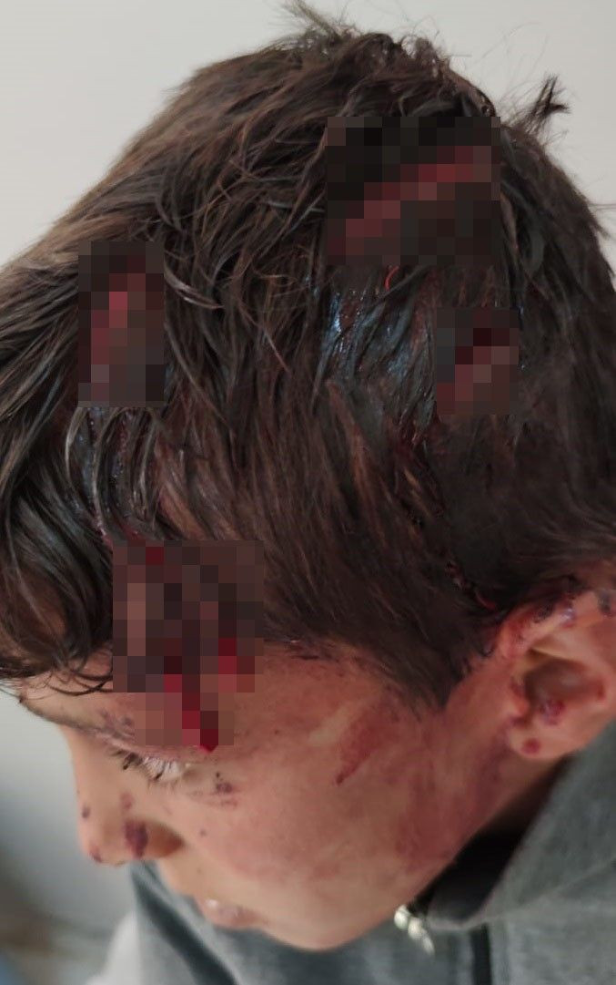 Van'da oğlunun öldüresiye dövdüğü çocuğu hastaneye götürdü: Kayalıklardan düşmüş - Resim: 4