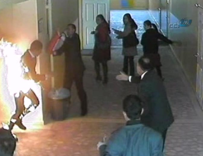 Liseli Onur cayır cayır yandı - Resim: 1