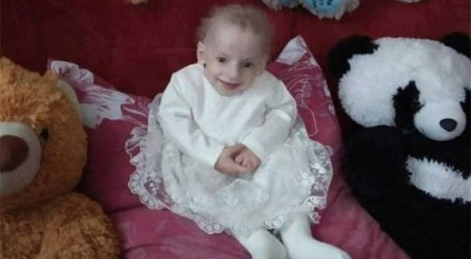 8 yaşında yaşlılık nedeniyle öldü nedeni duyanların ağzını açık bıraktı - Resim: 3