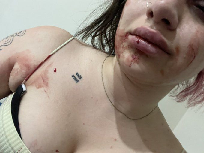 TikTok fenomeni Başak Ermiş'e oyuncu Can Topçu'dan tayt dayağı! 'Ölmek istemiyorum' - Resim: 4