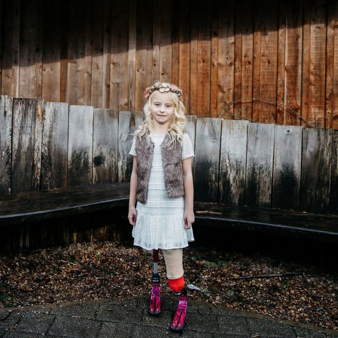 İki ayağı da kesilmiş minik manken tarihe geçti! Fotoğraflar sizi çok sarsacak - Resim: 4