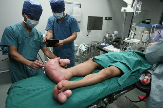 Ayakları görenleri dehşete düşürdü - Resim: 3